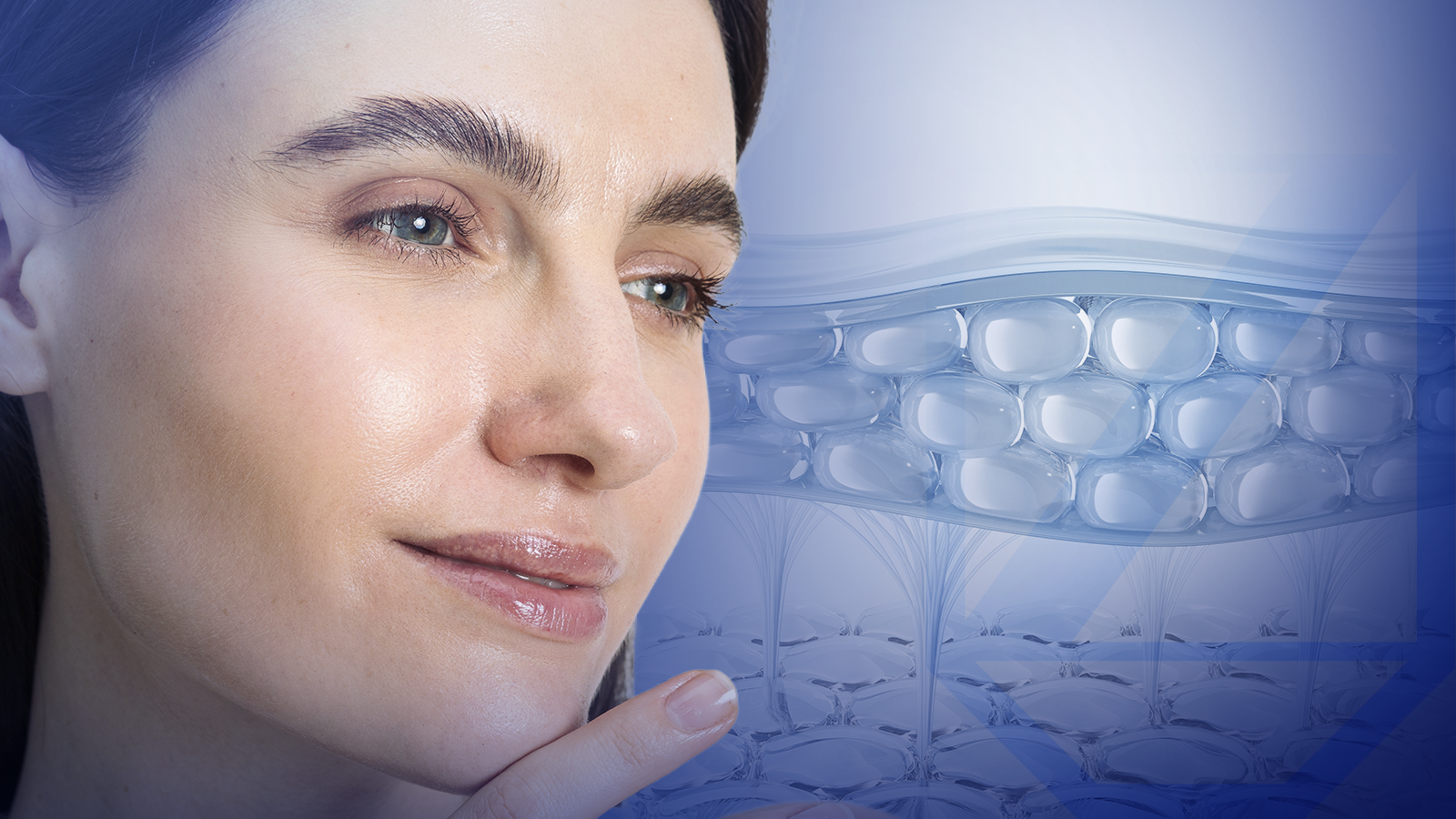 Bioestimuladores inyectables